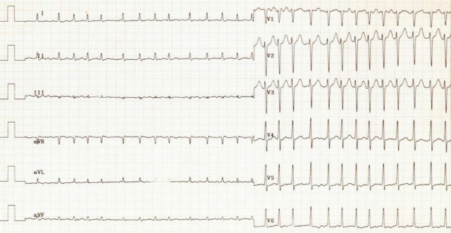 C:\Users\BMA\Pictures\ЭКГ ФП2.jpg C:\Users\BMA\Pictures\ЭКГ ФП2.jpg