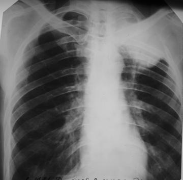 P1010230