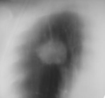 P1010233