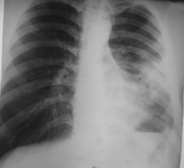 P1010245