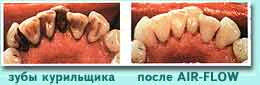https://studfile.net/html/612/64/html_sZ46jrh9SE.FJYf/img-KCfXch.png