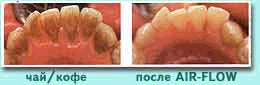 https://studfile.net/html/612/64/html_sZ46jrh9SE.FJYf/img-ZkV2Sw.png