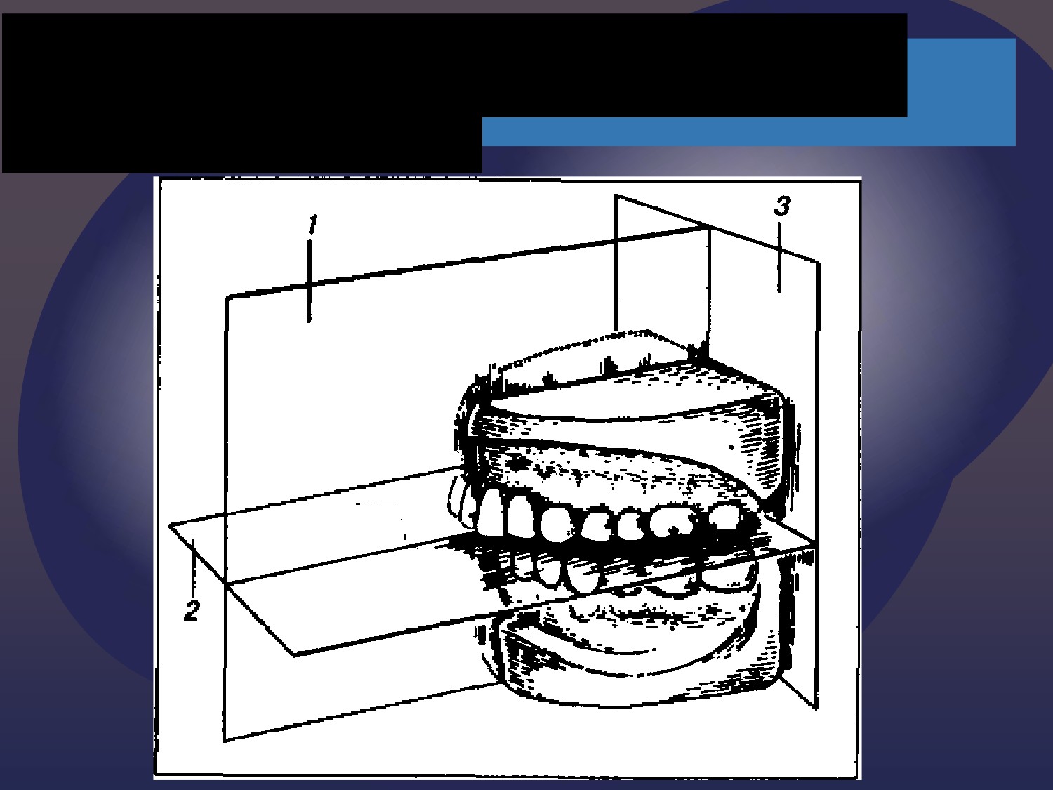 Сагиттальный размер канала норма. Трансверзальная плоскость в ортодонтии. Плоскости в стоматологии. Плоскости зубов в ортодонтии. Плоскости зуба в стоматологии.