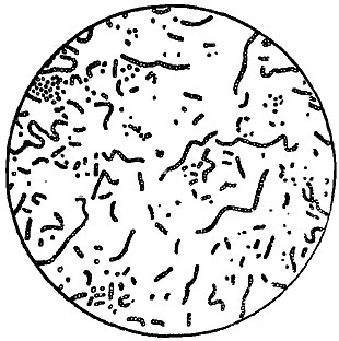 ���. 156. �������� �������� (Bacillus viscosus vini)